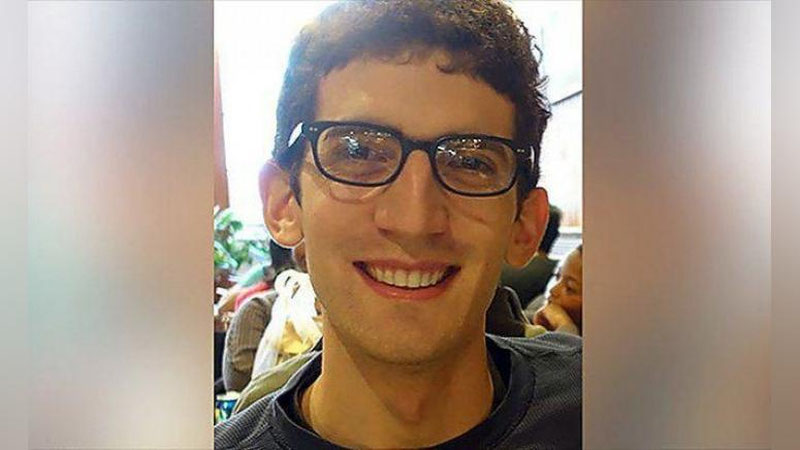 Изрображение 'Студент колледжа изготовил себе зубные имплантаты на 3D-принтере'