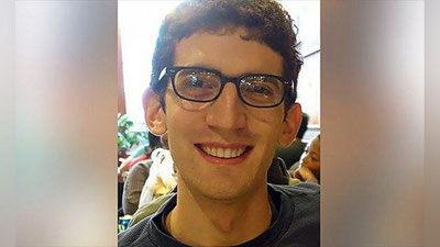 Изрображение 'Студент колледжа изготовил себе зубные имплантаты на 3D-принтере'