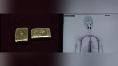 Изрображение 'В ташкентском аэропорту задержали пассажира с золотыми слитками во рту'