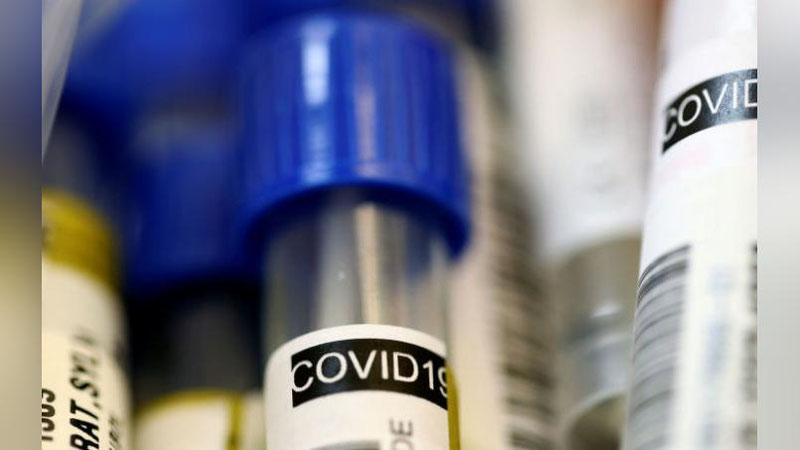 Изрображение 'В Бухаре умер 57-летний пациент с COVID-19'