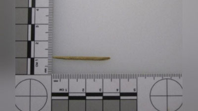 Изрображение 'ЖЕНЩИНА В ПОРТУГАЛИИ СЛУЧАЙНО ПРОГЛОТИЛА ЗУБОЧИСТКУ И УМЕРЛА'