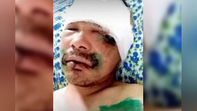 Изрображение 'Мужчина спасся от напавшего на него медведя, откусив ему язык (видео)'