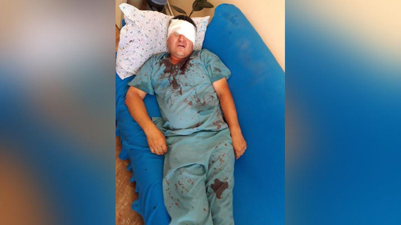 Изрображение 'Состояние врача, пострадавшего от рук отца умершей в больнице девочки, остается тяжелым'