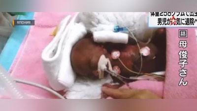 Изрображение 'В ЯПОНИИ ВЫХОДИЛИ МЛАДЕНЦА ВЕСОМ 258 ГРАММОВ (ВИДЕО)'