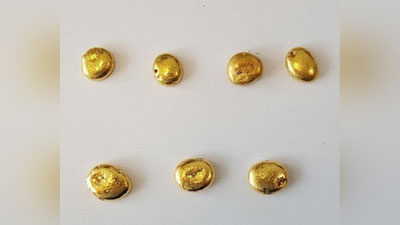 Изрображение 'В АЭРОПОРТУ ТАШКЕНТА ЗАДЕРЖАЛИ ПАССАЖИРА С ЗОЛОТЫМИ СЛИТКАМИ В ЖЕЛУДКЕ'