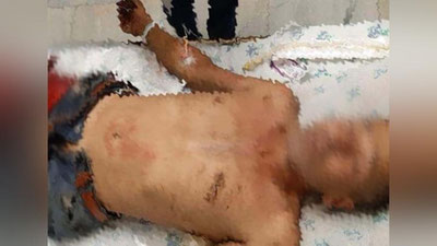 Изрображение 'Житель Андижанской области остался без ног, попав под поезд'