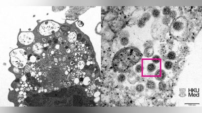 Изрображение 'Ученые впервые сделали фотоснимок омикрон-штамм коронавируса'