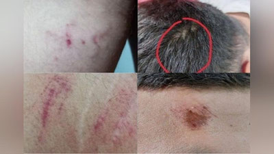 '“Sevimli” телеканалининг журналист ва тасвирчисига куч ишлатилганлар устидан  дастлабки тергов ҳаракатлари бошланди'ning rasmi