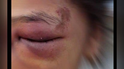 Изрображение 'Девочку из Шафиркана, избиваемую отцом и мачехой, спасли от "домашнего ада"'