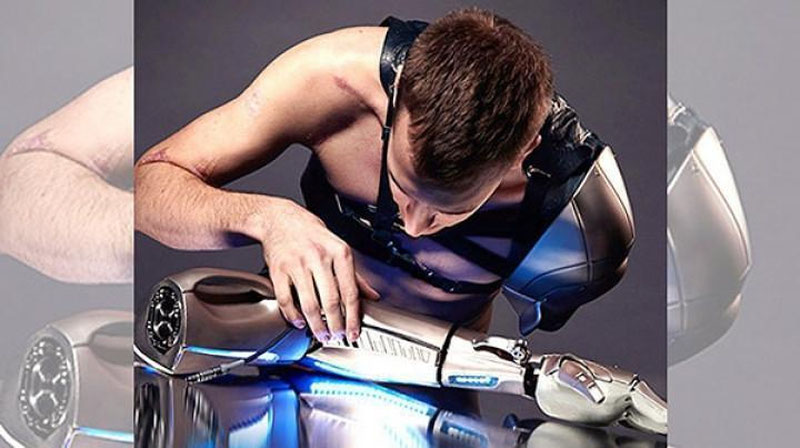 Изрображение 'Инвалиду сделали протез руки в стиле игры Metal Gear Solid V'