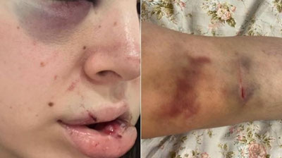 'Toshkenda xotinini ayovsiz kaltaklab, erto`lada saqlagan erkak qamoqdan uy qamog`iga o`tkazildi'ning rasmi