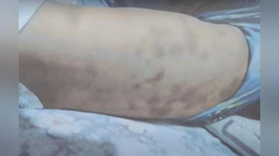 'Samarqandda yosh bolani urib, qovurg`alarini sindirgan enagaga hukm o`qildi (video)'ning rasmi