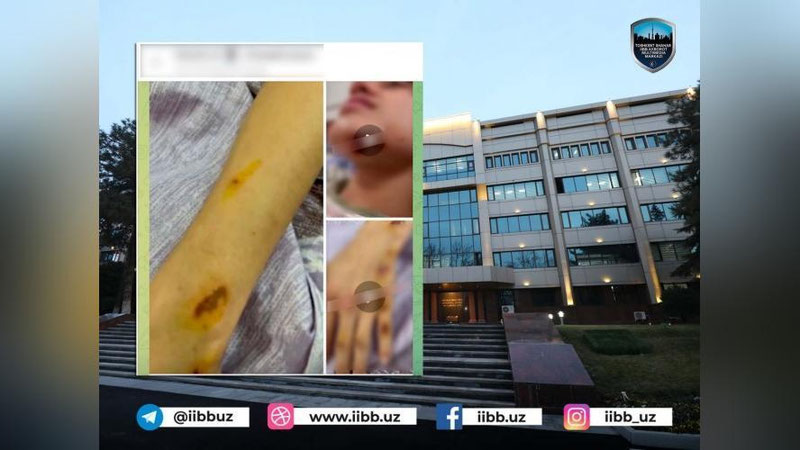 'Toshkentda maktab o`quvchilari o`zaro janjallashdi. Jarohatlanganlar bor'ning rasmi