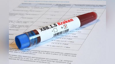 '“Omikron”ning XBB.1.5 subvarianti yangi belgilar bilan namoyon bo`lmoqda - JSST'ning rasmi