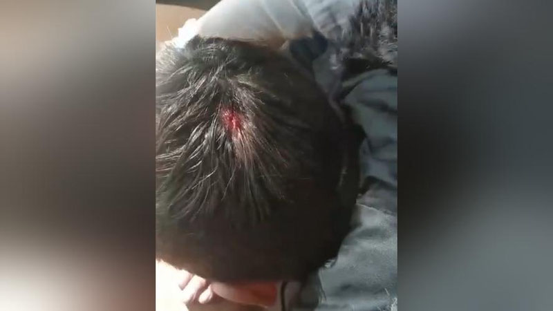 Изрображение 'В Маргилане учительница бросила в школьника телефон, разбив ему голову'