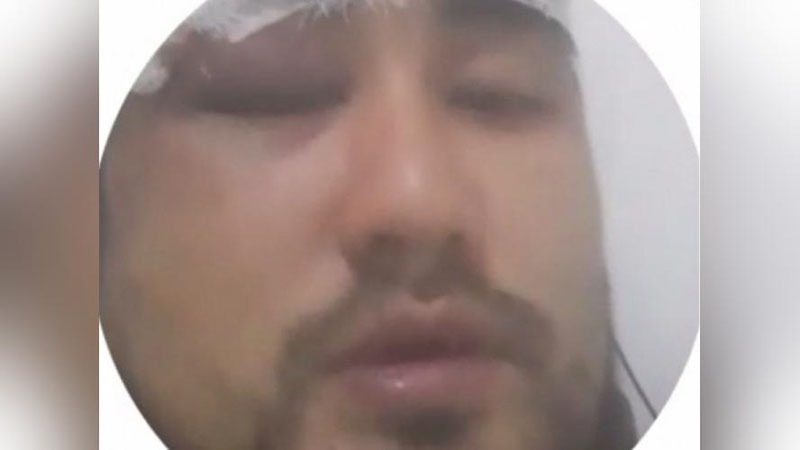 'Фарғонада ИИО ходими собиқ ўқитувчини калтаклади (видео)'ning rasmi