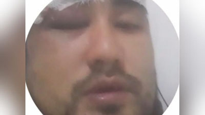 'Фарғонада ИИО ходими собиқ ўқитувчини калтаклади (видео)'ning rasmi