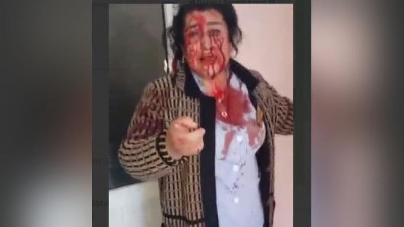 'Samarqanddagi shifoxonada tibbiyot xodimlari janjallashdi (video)'ning rasmi