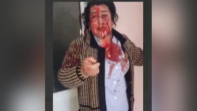 'Samarqanddagi shifoxonada tibbiyot xodimlari janjallashdi (video)'ning rasmi