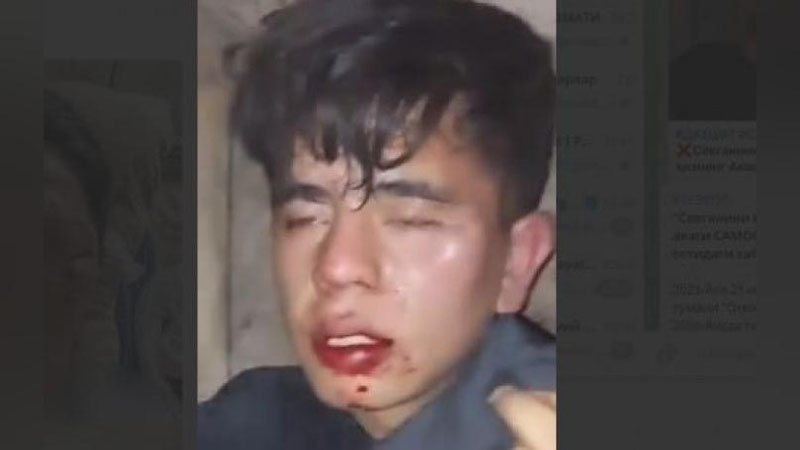 'Samarqandda sevganining yoniga kelgan bola qizning akasi tomonidan "samosud" qilindi (video)'ning rasmi