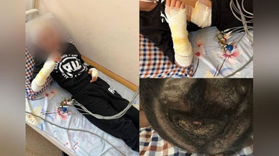 'Sirdaryoda transformator ostidagi kuchukni qutqarmoqchi bo`lgan 2-sinf o`quvchisini tok urdi'ning rasmi