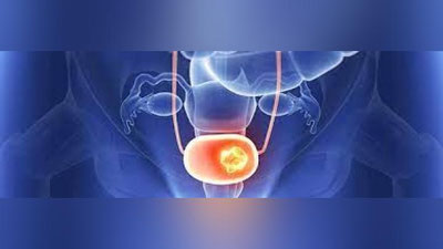 'Ўзбекистон бўйлаб гепатит ва бачадон бўйин саратонига текин текширувлар ўтказилмоқда (манзиллар)'ning rasmi