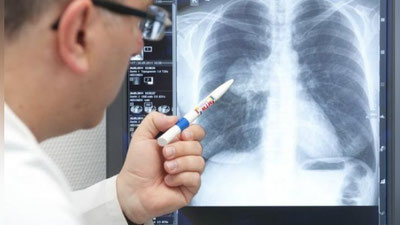 'O`zbekistonda pnevmoniyadan kasallanish oshib bormoqda'ning rasmi