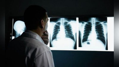 'Koronavirusga chalingan qanday bemorlar orasida o`lim kuzatilayotgani ochiqlandi'ning rasmi