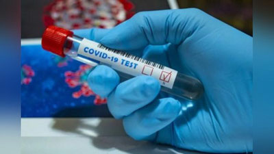 'O`zbekistonda yana 72 kishi koronavirus bilan zararlandi'ning rasmi
