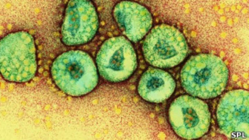 'O`zbekistonda pnevmoniyadan vafot etganlar soni 219 nafarga etdi'ning rasmi