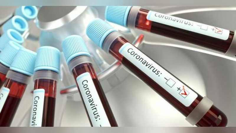 Изрображение 'Статистика COVID-19 от Минздрава Узбекистана по итогам 18 февраля'