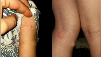 'Самарқандда болакайга зулм қилган боғча тарбиячиси ишдан бўшатилди'ning rasmi