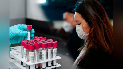 'Ayni vaqtda yurtimizda 95 kishida virus aniqlandi, 243 nafar bemor sog`aydi'ning rasmi