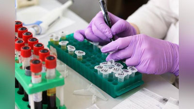 '6 soat ichida 206 kishida koronavirus infeksiyasi aniqlandi'ning rasmi