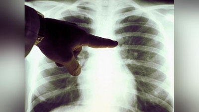 'Bolalar pnevmoniyaga chalinmasligi uchun nimalarga e`tibor berishi lozimligi aytildi'ning rasmi