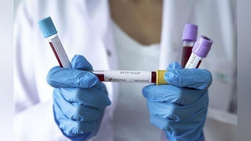 'Buxoroda o`qituvchilar koronavusga test topshirishdi'ning rasmi