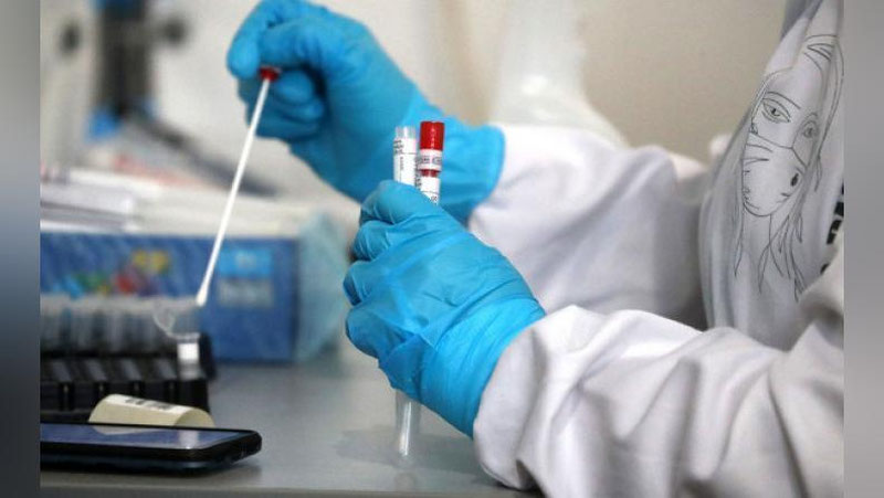 'Россиялик олимлар коронавирусни сақич ёрдамида даволамоқчи'ning rasmi