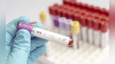 'OIV muolajasi uchun zarur preparatlarning aksariyati davlat byudjeti hisobidan qoplanadi — SSV'ning rasmi