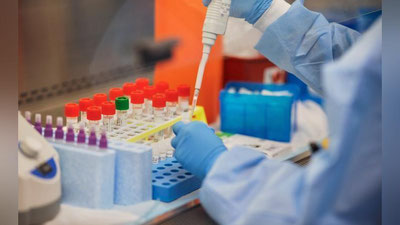'12-oktyabr. Yurtimizda koronavirus qayd etilganlar  321 nafarni, vafot etganlar 4 nafarni tashkil qildi'ning rasmi