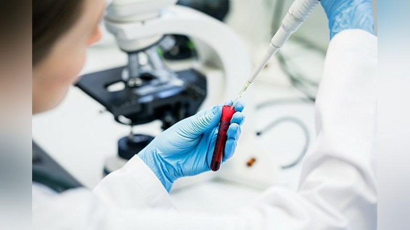 'Irlandiya aholisiga koronavirus tufayli o`z uylaridan 5 kilometrdan ortiq uzoqlashish taqiqlandi'ning rasmi