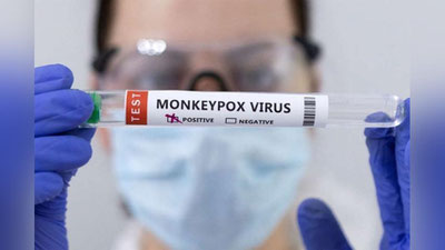 'JSST: Maymun chechagi virusiga qayta nom beriladi'ning rasmi