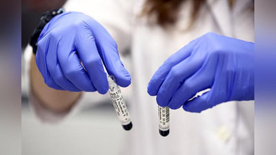 'Кеча дунё бўйича 3,18 миллион кишида коронавирус инфекцияси аниқланди'ning rasmi