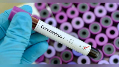 'Toshkent shahrida 104, Andijonda 54 fuqaroda koronavirus aniqlandi'ning rasmi