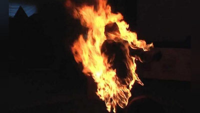 Изрображение 'Житель Андижанской области, совершивший самоподжог, умер в больнице'