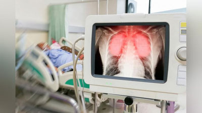 'Qoraqalpog`istonda 42 yoshli erkak koronavirusdan vafot etdi'ning rasmi