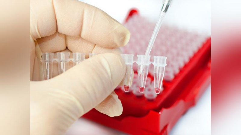 'Kitob tumani markaziy shifoxonasida yotgan bemorlarda koronavirus aniqlanmagan'ning rasmi