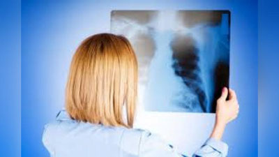 'Pnevmoniya bo`yicha kunlik ko`rsatkichlar ma`lum qilindi'ning rasmi