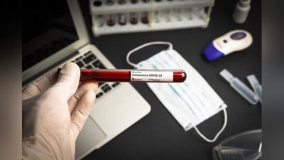 'DXX “COVID-19” testini soxtalashtirayotgan guruhni fosh etdi'ning rasmi