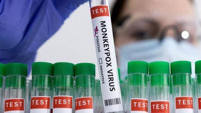 'Маймун чечаги: ЖССТ хавф остидаги аҳоли қатламига эмланишни тавсия этди'ning rasmi