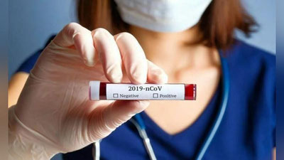 'Dunyoda virus yuqtirganlar 41 million 228 mingdan oshdi, 1 million 131 mingdan ortiq bemor vafot etgan'ning rasmi